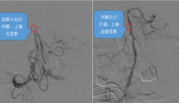 生死竞速！多学科协作打通“生命通道”