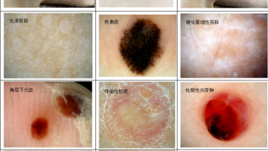 皮肤问题困扰？专家为您支招！
