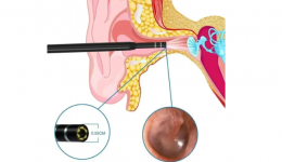 102岁超高龄患者耳疾治愈，高龄手术“禁区”再突破