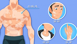 告别白斑困扰 重拾健康肤色 | 市七院皮肤科“白癜风专病门诊”正式开诊！